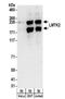 Lemur Tyrosine Kinase 2 antibody, NBP2-32182, Novus Biologicals, Western Blot image 