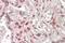 MAX Dimerization Protein MLX antibody, GTX88235, GeneTex, Immunohistochemistry paraffin image 