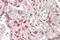 MLX antibody, GTX88235, GeneTex, Immunohistochemistry paraffin image 