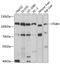 Integrin Subunit Beta 3 antibody, 13-023, ProSci, Western Blot image 