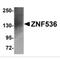 Zinc finger protein 536 antibody, MBS150992, MyBioSource, Western Blot image 