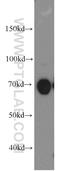 Protein Kinase C Delta antibody, 19132-1-AP, Proteintech Group, Western Blot image 