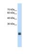 Transmembrane Protein 178A antibody, orb325049, Biorbyt, Western Blot image 