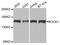 Rho Associated Coiled-Coil Containing Protein Kinase 1 antibody, abx005950, Abbexa, Western Blot image 