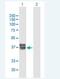 Kazal Type Serine Peptidase Inhibitor Domain 1 antibody, H00081621-B01P-50ug, Novus Biologicals, Western Blot image 