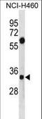 Syndecan Binding Protein antibody, LS-C156033, Lifespan Biosciences, Western Blot image 