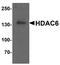 Histone Deacetylase 6 antibody, NBP2-41286, Novus Biologicals, Western Blot image 