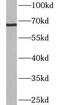 Ankyrin Repeat And SOCS Box Containing 14 antibody, FNab00621, FineTest, Western Blot image 