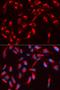 WASP Like Actin Nucleation Promoting Factor antibody, orb136618, Biorbyt, Immunofluorescence image 