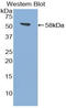 Transglutaminase 1 antibody, LS-C302927, Lifespan Biosciences, Western Blot image 