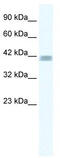 Zinc Finger Protein 529 antibody, TA339523, Origene, Western Blot image 