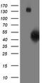 Spermine Synthase antibody, TA503098, Origene, Western Blot image 