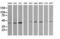 Mitogen-Activated Protein Kinase Kinase 1 antibody, LS-C174637, Lifespan Biosciences, Western Blot image 