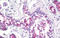 Mucin 1, Cell Surface Associated antibody, AM32800PU-N, Origene, Immunohistochemistry frozen image 