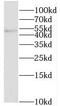 Serum/Glucocorticoid Regulated Kinase 2 antibody, FNab07807, FineTest, Western Blot image 