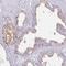 Solute Carrier Family 17 Member 9 antibody, HPA056499, Atlas Antibodies, Immunohistochemistry paraffin image 