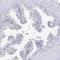 Myozenin 2 antibody, HPA035763, Atlas Antibodies, Immunohistochemistry paraffin image 