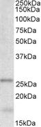 Tubulin Polymerization Promoting Protein antibody, EB09800, Everest Biotech, Western Blot image 