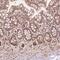 TBC1 Domain Family Member 17 antibody, HPA068119, Atlas Antibodies, Immunohistochemistry frozen image 