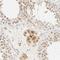 Acyl-CoA Synthetase Short Chain Family Member 2 antibody, NBP1-90276, Novus Biologicals, Immunohistochemistry frozen image 