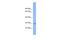 Chromosome 6 Open Reading Frame 203 antibody, A16320, Boster Biological Technology, Western Blot image 