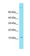 Rho Guanine Nucleotide Exchange Factor 39 antibody, orb326834, Biorbyt, Western Blot image 