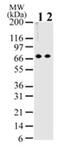 Methyl-CpG Binding Domain Protein 1 antibody, GTX76673, GeneTex, Western Blot image 