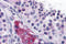 Dispatched RND Transporter Family Member 3 antibody, 4915, ProSci, Immunohistochemistry frozen image 