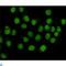 Structural Maintenance Of Chromosomes 1A antibody, LS-C814126, Lifespan Biosciences, Immunocytochemistry image 