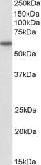 Snf2 Related CREBBP Activator Protein antibody, 42-210, ProSci, Enzyme Linked Immunosorbent Assay image 