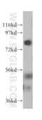 Lipase Maturation Factor 2 antibody, 16249-1-AP, Proteintech Group, Western Blot image 