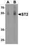 Interleukin 1 Receptor Like 1 antibody, PA5-20077, Invitrogen Antibodies, Western Blot image 