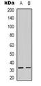 Alkaline Ceramidase 3 antibody, LS-C368687, Lifespan Biosciences, Western Blot image 