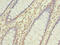 DnaJ Heat Shock Protein Family (Hsp40) Member C17 antibody, CSB-PA873664LA01HU, Cusabio, Immunohistochemistry paraffin image 