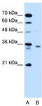 Ras Converting CAAX Endopeptidase 1 antibody, TA335719, Origene, Western Blot image 