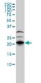 Rho-related GTP-binding protein RhoJ antibody, H00057381-M01, Novus Biologicals, Western Blot image 