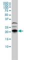 TCL antibody, H00057381-M01, Novus Biologicals, Western Blot image 