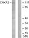 Connector Enhancer Of Kinase Suppressor Of Ras 2 antibody, TA315195, Origene, Western Blot image 