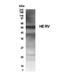 Endogenous Retrovirus Group W Member 1, Envelope antibody, NB100-93579, Novus Biologicals, Western Blot image 