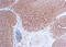 Fms Related Tyrosine Kinase 1 antibody, GTX22350, GeneTex, Immunohistochemistry paraffin image 