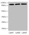 Adhesion G Protein-Coupled Receptor E5 antibody, LS-C675491, Lifespan Biosciences, Western Blot image 