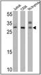 T Cell Receptor Alpha Constant antibody, NBP2-22491, Novus Biologicals, Western Blot image 