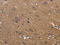 REL Proto-Oncogene, NF-KB Subunit antibody, CSB-PA038229, Cusabio, Immunohistochemistry paraffin image 