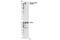 Platelet Derived Growth Factor Receptor Alpha antibody, 4547S, Cell Signaling Technology, Western Blot image 