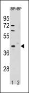 Serine/Threonine Kinase 25 antibody, LS-C203829, Lifespan Biosciences, Western Blot image 