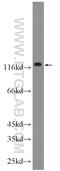 TELO2 Interacting Protein 1 antibody, 22381-1-AP, Proteintech Group, Western Blot image 