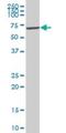 VRK Serine/Threonine Kinase 2 antibody, H00007444-B01P, Novus Biologicals, Western Blot image 