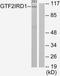 GTF2I Repeat Domain Containing 1 antibody, TA314934, Origene, Western Blot image 