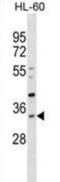 Sulfotransferase Family 1B Member 1 antibody, abx028961, Abbexa, Western Blot image 