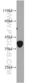 Clathrin Light Chain A antibody, 10852-1-AP, Proteintech Group, Western Blot image 